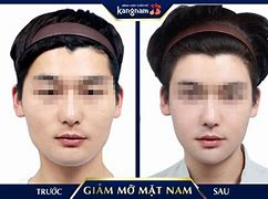 Cách Làm Béo Mặt Cho Nam