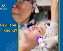 Đi Spa Có Phải Tip Không